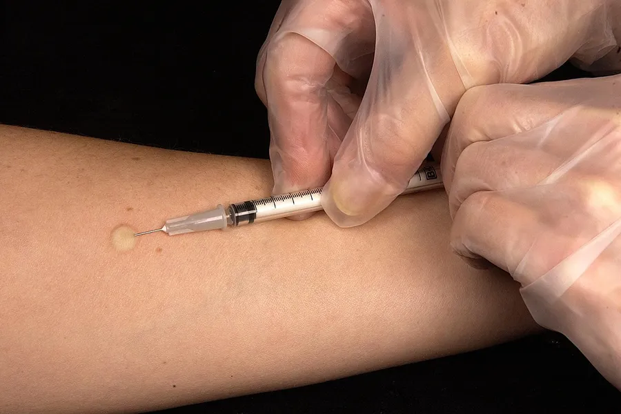 Vaccination